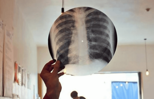 Foto de um disco feito de raio-x